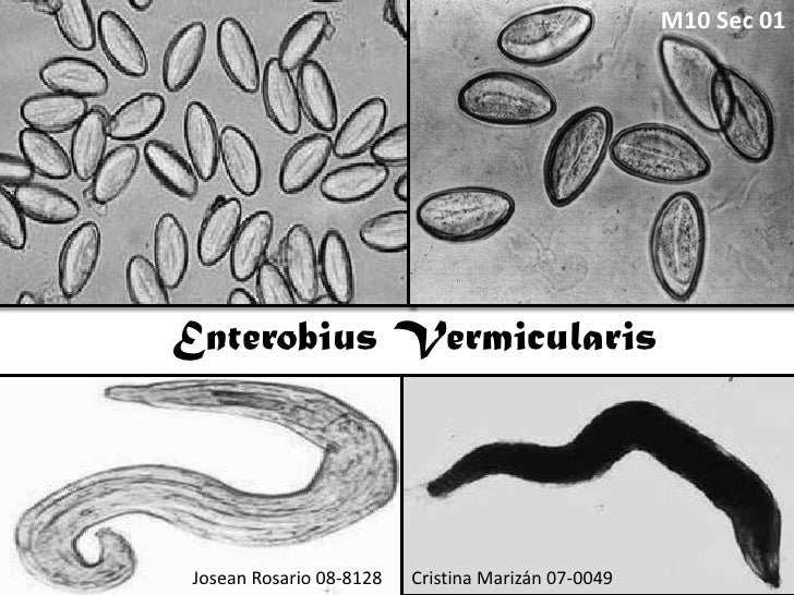 enterobius vermicularis oxiuros